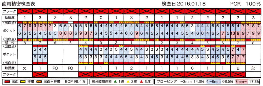 初診時の歯周精密検査表