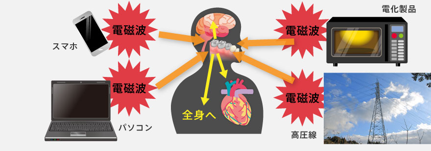 スマホや家電製品など身の回りの電磁波が歯科金属に引き寄せられます