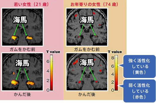 ガムを噛む前後の脳の比較