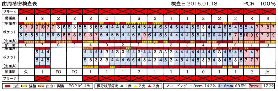 初診時の歯周精密検査表