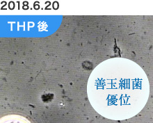 治療後　善玉細菌優位　THP後