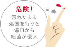 危険！ 汚れたまま処置を行うと傷口から細菌が侵入