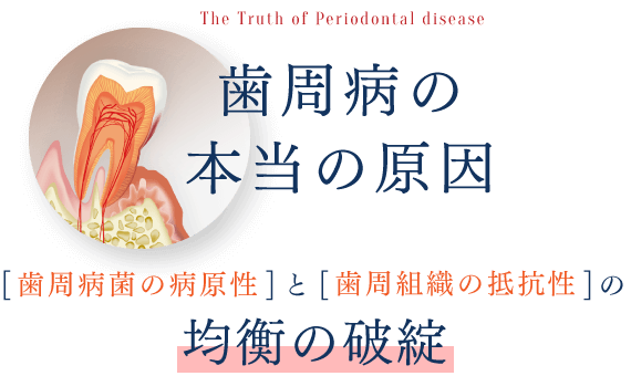 「歯周病菌の病原性」と「歯周組織の抵抗性」の均衡の破綻