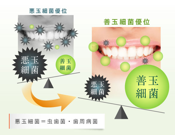 悪玉細菌優位の口内フローラを善玉細菌優位に変えます